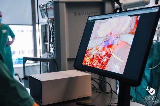 First-in-man AR-guided robotic surgery First-in-man AR-guided robotic surgery